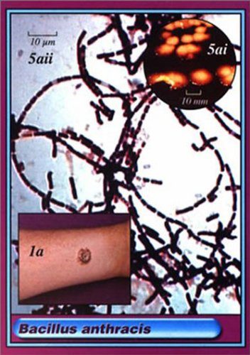 Microbe Cards