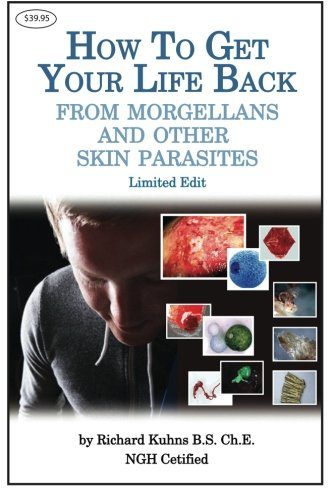 How to Get Your Life Back From Morgellons and Other Skin Parasites Limited Edit