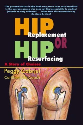Hip Replacement or Hip Resurfacing: A Story of Choices