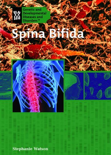 Spina Bifida (Genetic and Developmental Diseases and Disorders)