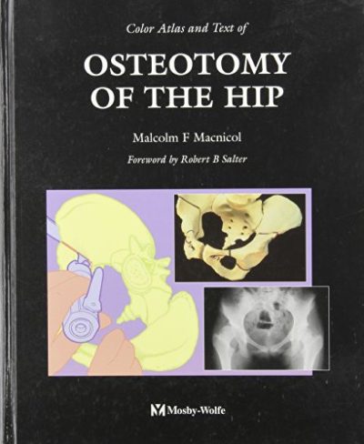 Color Atlas And Text Of Osteotomy Of The Hip, 1e